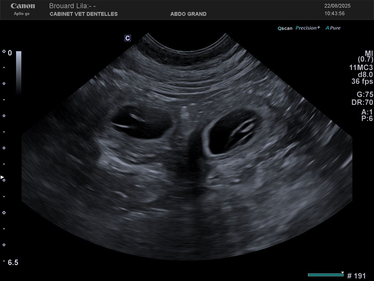 Echographie du 22 aout 2025